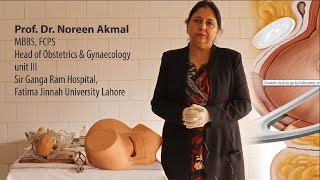 Prof Dr Noreen Akmal  Forceps Delivery Part 1 [upl. by Loralyn]