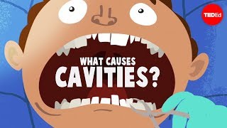 What causes cavities  Mel Rosenberg [upl. by Gelhar9]