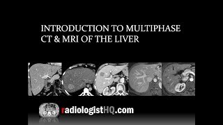 Liver Ultrasound Normal Vs Abnormal Image Appearances Comparison  Liver Ultrasound Pathologies [upl. by Anivlem9]